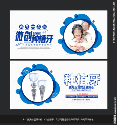 种植牙设计图 精准美学与高效传播的交汇点